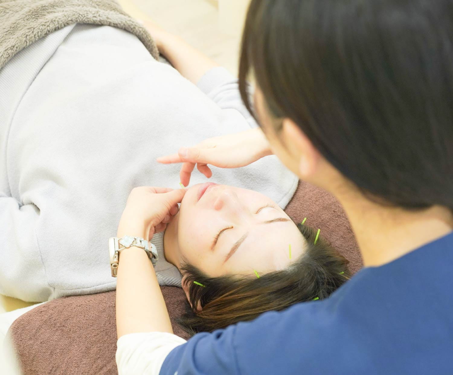 目を閉じた女性の額やこめかみに鍼が刺さり、施術者の手があごに添えられている